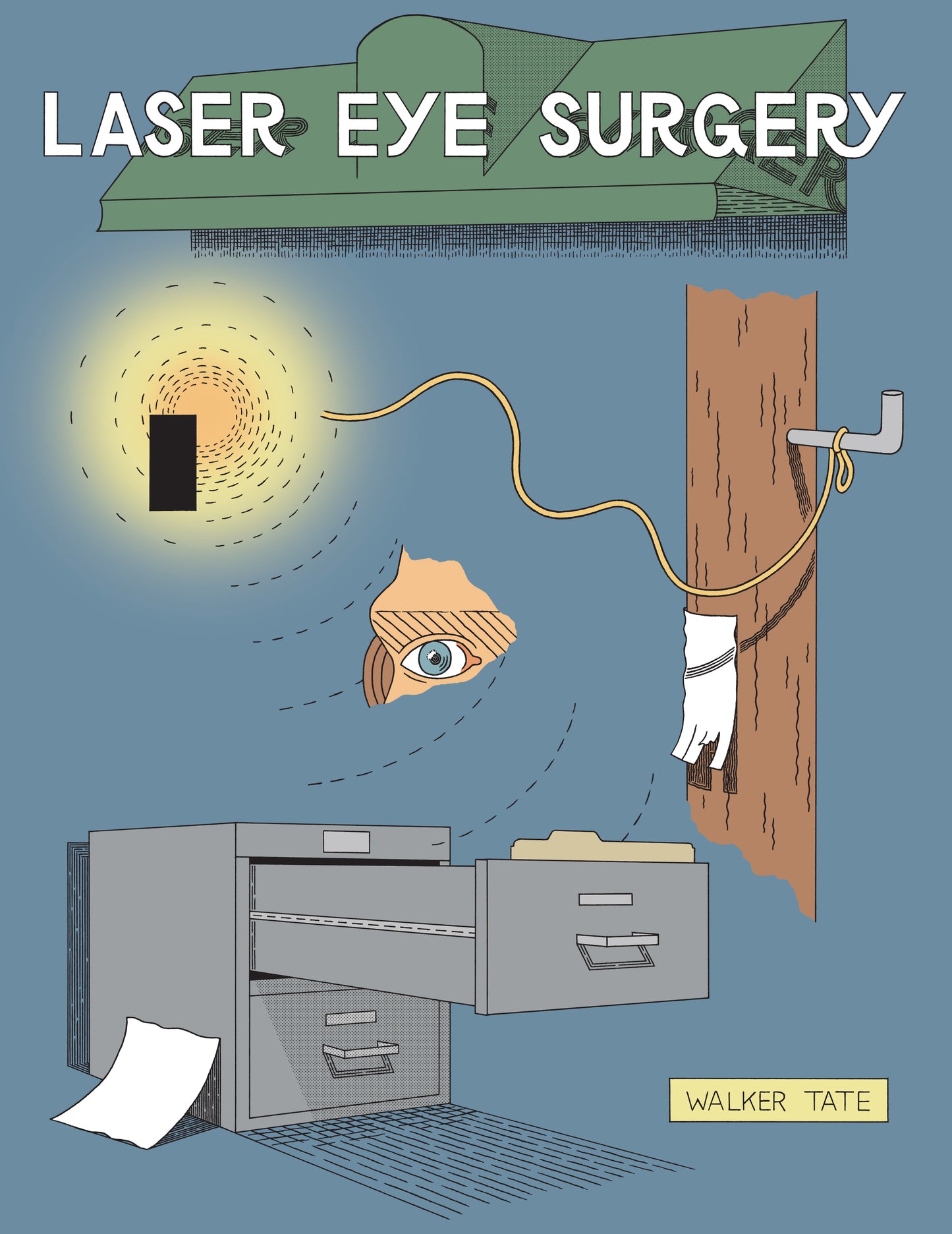 LASER EYE SURGERY TP (MR)